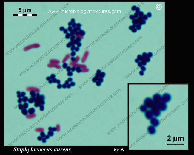 S.aureus, E.coli Gram